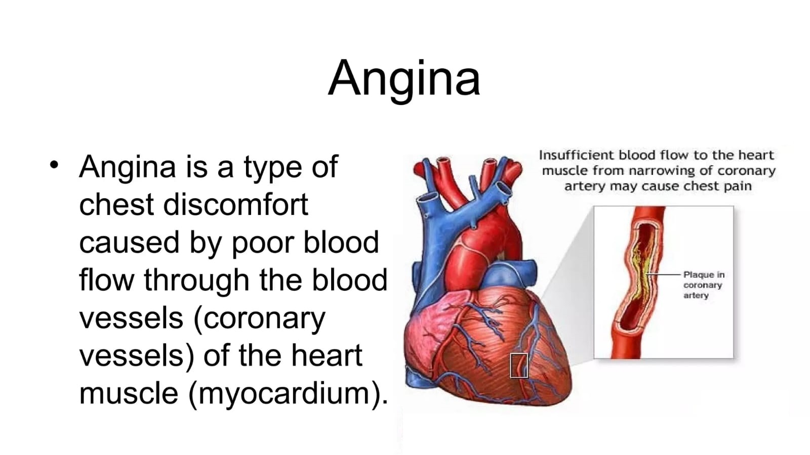 EECP-Angina-Treatment-Das-Clinic-Healthcare